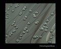 neisseria gonorrhoeae